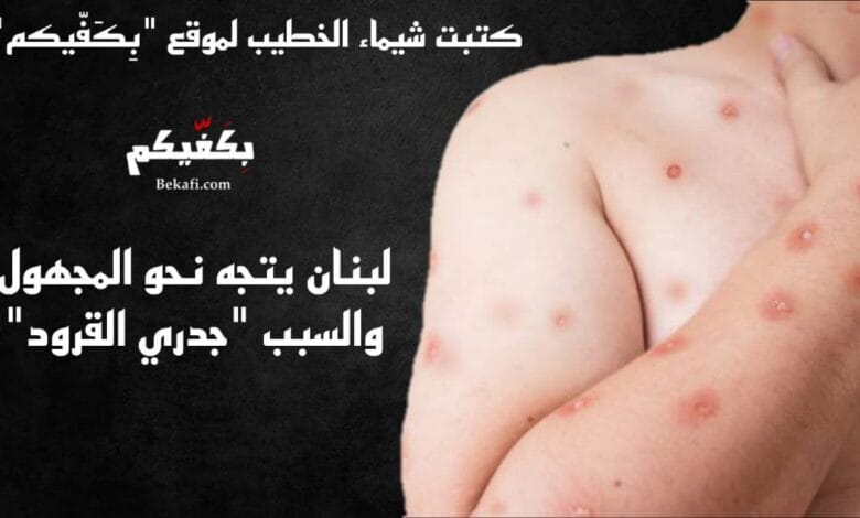 لبنان يتجه نحو المجهول! والسبب "جدري القرود"!