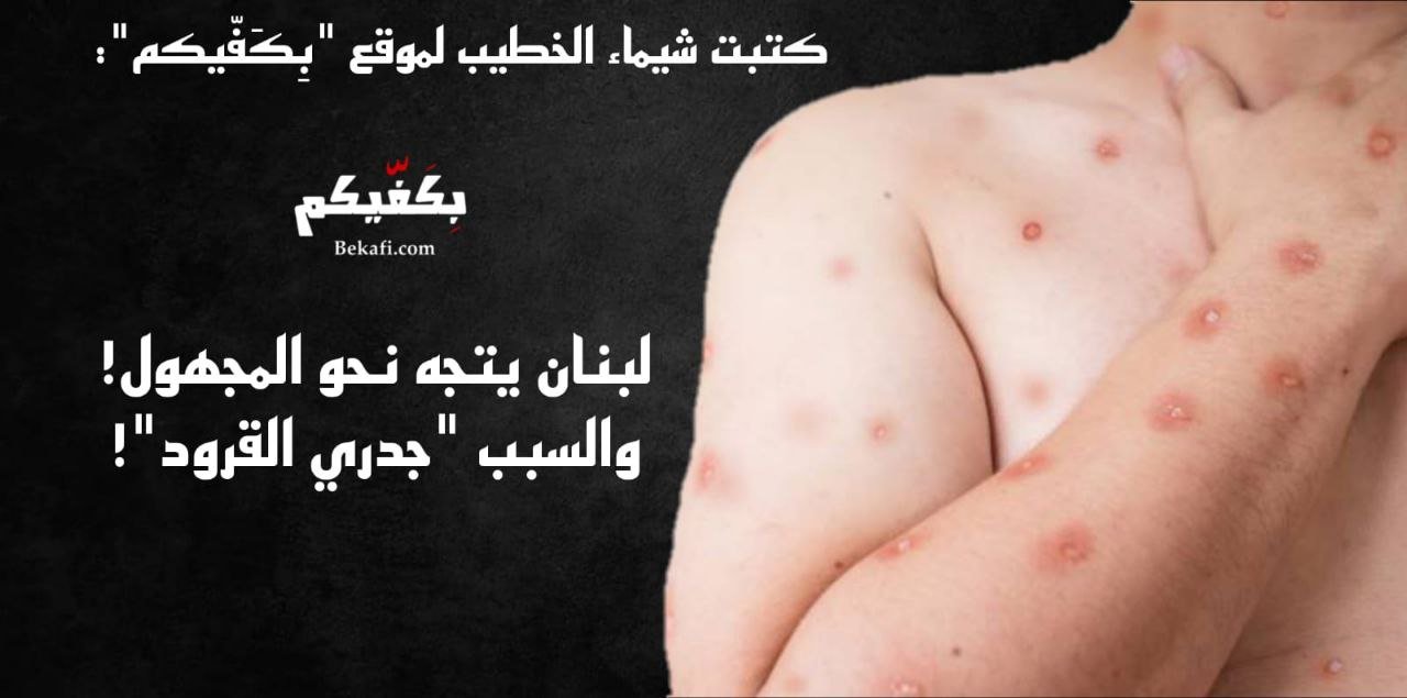 لبنان يتجه نحو المجهول! والسبب "جدري القرود"!